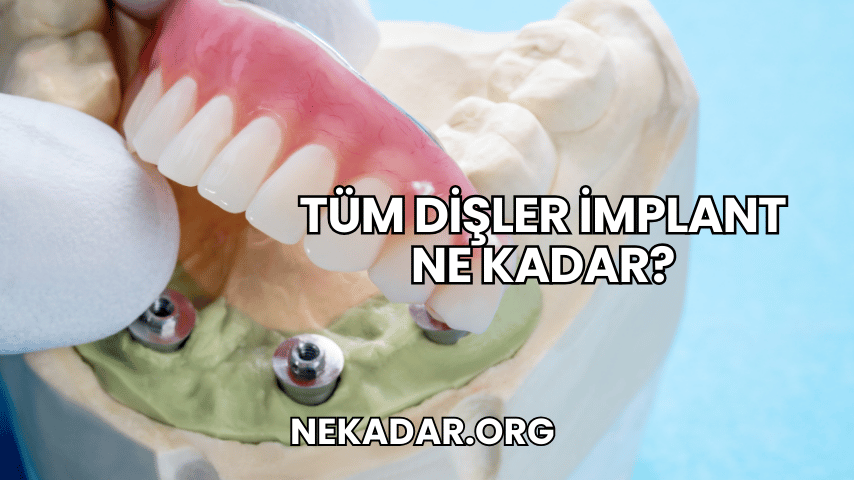 Tüm Dişler İmplant Ne Kadar?