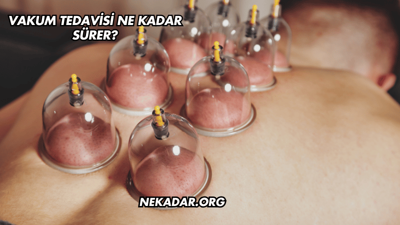 Vakum Tedavisi Ne Kadar Sürer?